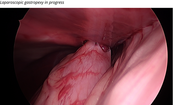 Laparoscopic Gastropexy in Progress